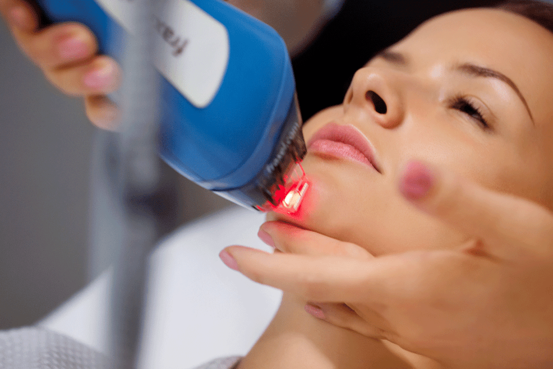 rajeunissement de la peau du visage au laser