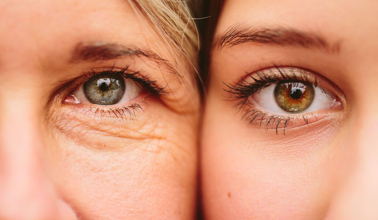 signes de vieillissement autour des yeux